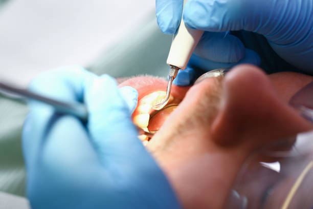 Urgent Tooth Repair in AL